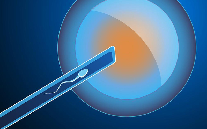 丽水捐卵高薪招聘