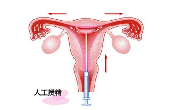 少女经期肚子疼