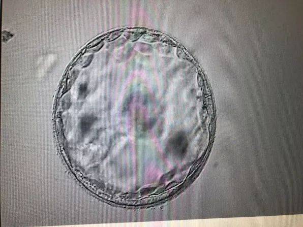 怀孕了可以喝咖啡吗