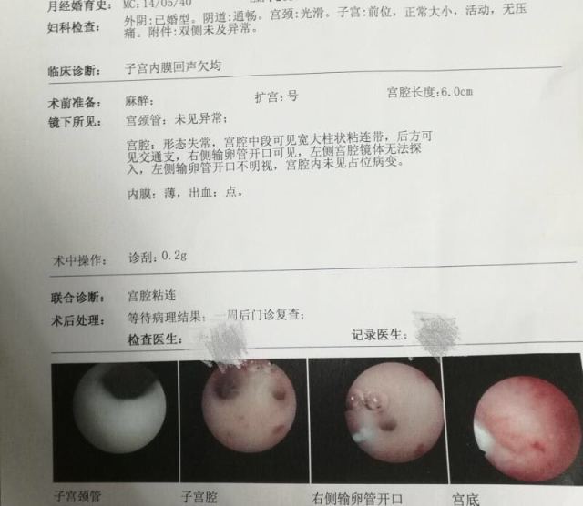 少女经期肚子疼